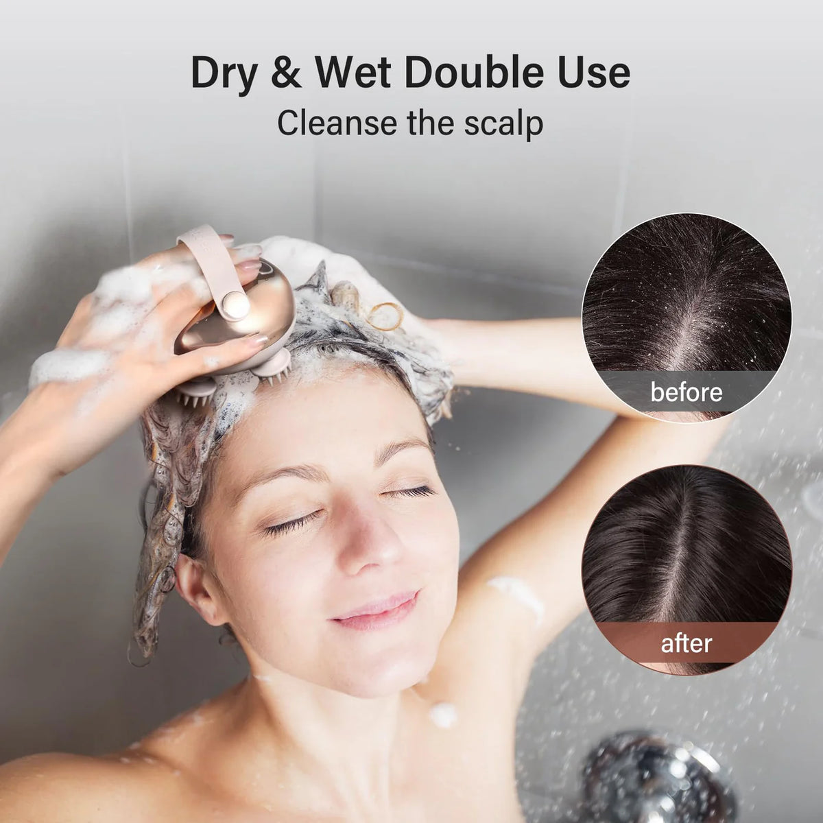 Electric Octopus Head Massager – Deep Scalp Massage for Stress Relief, Headache & Hair Growth | IPX7 Waterproof